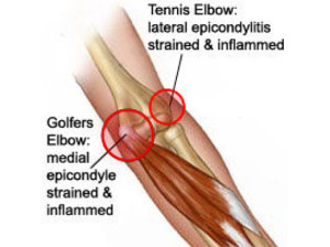 Photo: scpilatespt.com